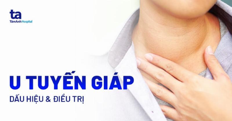 Mô tả hình ảnh các yếu tố tiềm ẩn rủi ro khi bà bầu ăn rong biển, bao gồm ký hiệu nguy hiểm cho i-ốt dư thừa, biểu tượng hóa chất cho kim loại nặng và muối.