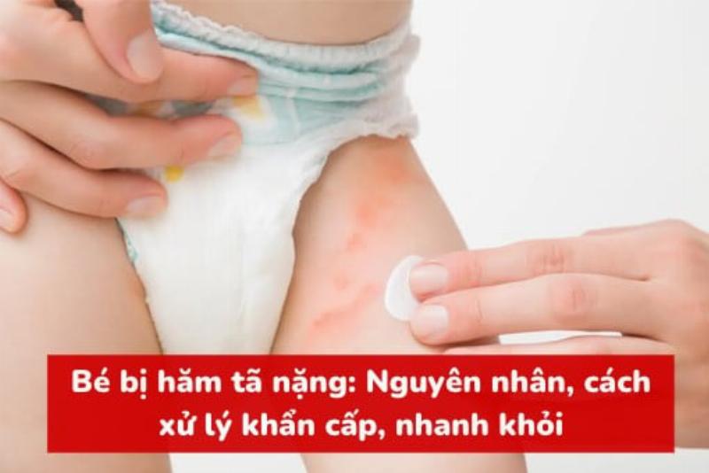 Một bộ sưu tập nhỏ các loại trứng cá tầm khác nhau được trưng bày trong những hộp nhỏ, kèm theo muỗng xà cừ, làm nổi bật sự đa dạng và sang trọng của sản phẩm.