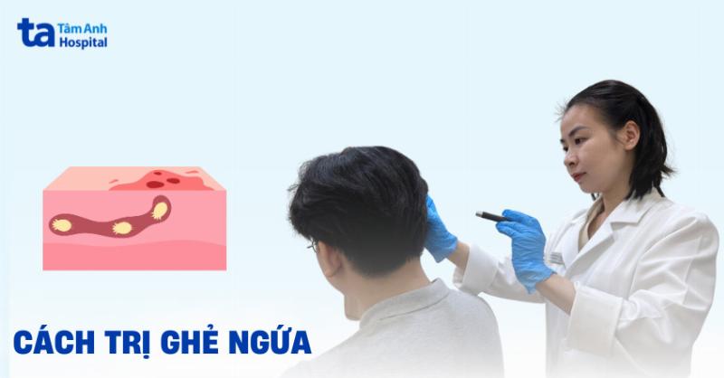 Hinh anh huong dan cach lua chon ghe tuoi ngon va che bien ghe an toan tai nha